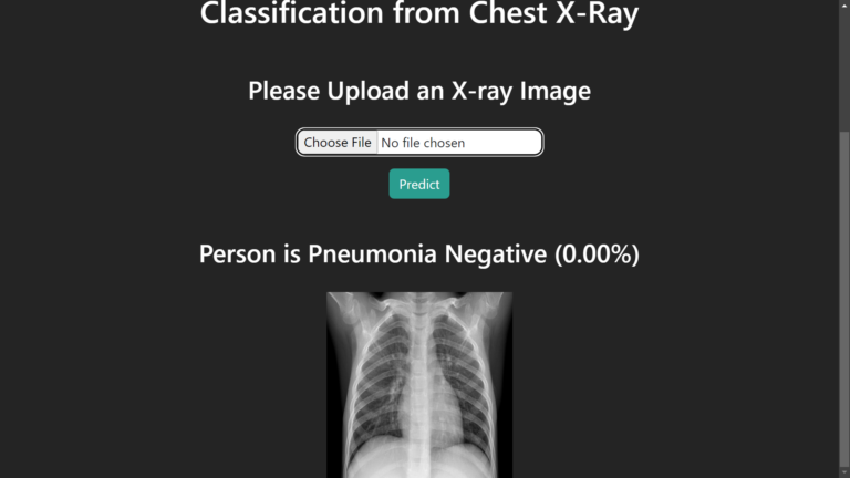 Pneumonia Detection from Chest X-Ray with Flask App Deep Learning ...