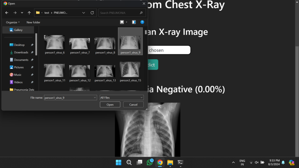 Pneumonia Detection from Chest X-Ray with Flask App Deep Learning ...