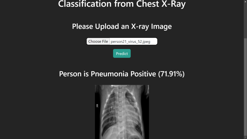 Pneumonia Detection from Chest X-Ray with Flask App Deep Learning ...