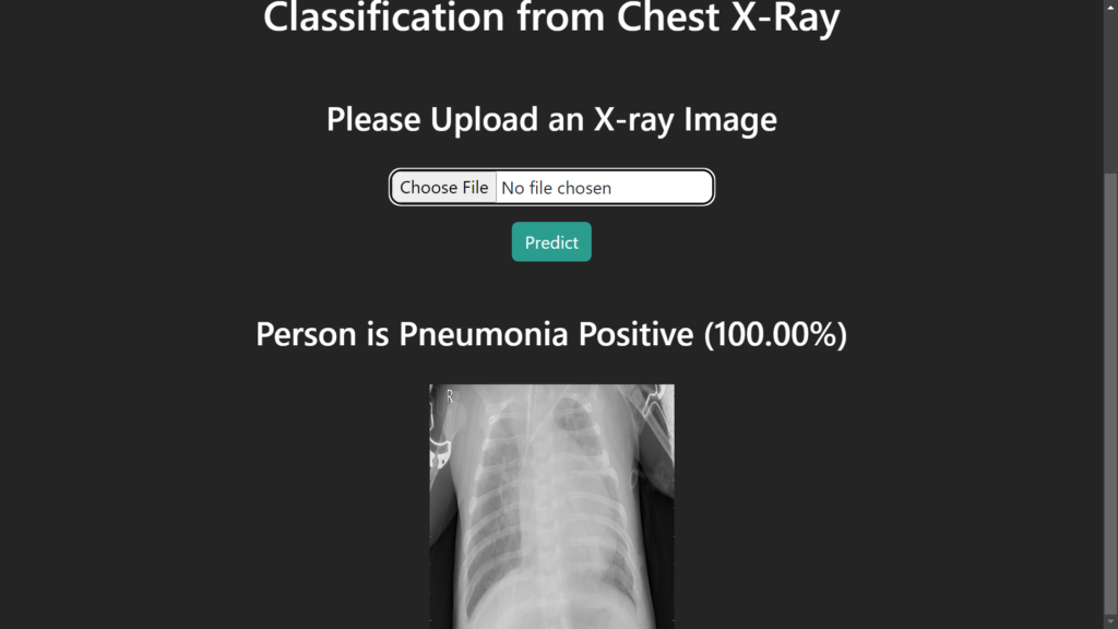 Pneumonia Detection from Chest X-Ray with Flask App Deep Learning ...